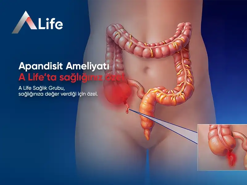 Apandisit Ameliyatı